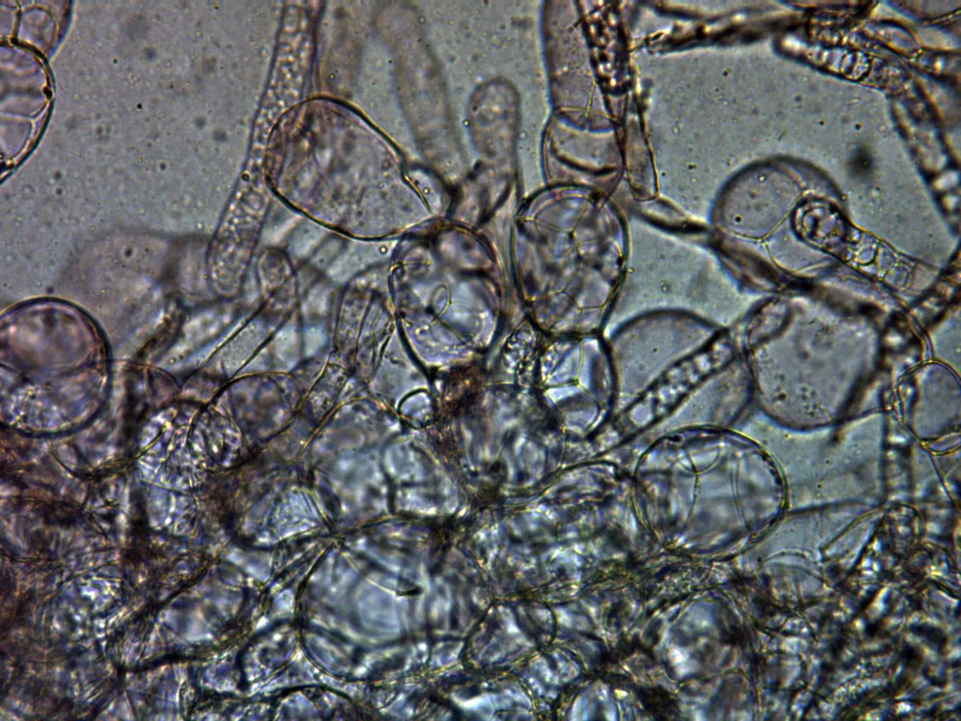 Microscopía de Morchella esculenta - 10 - Excípulo x 400